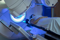 Radiotherapy